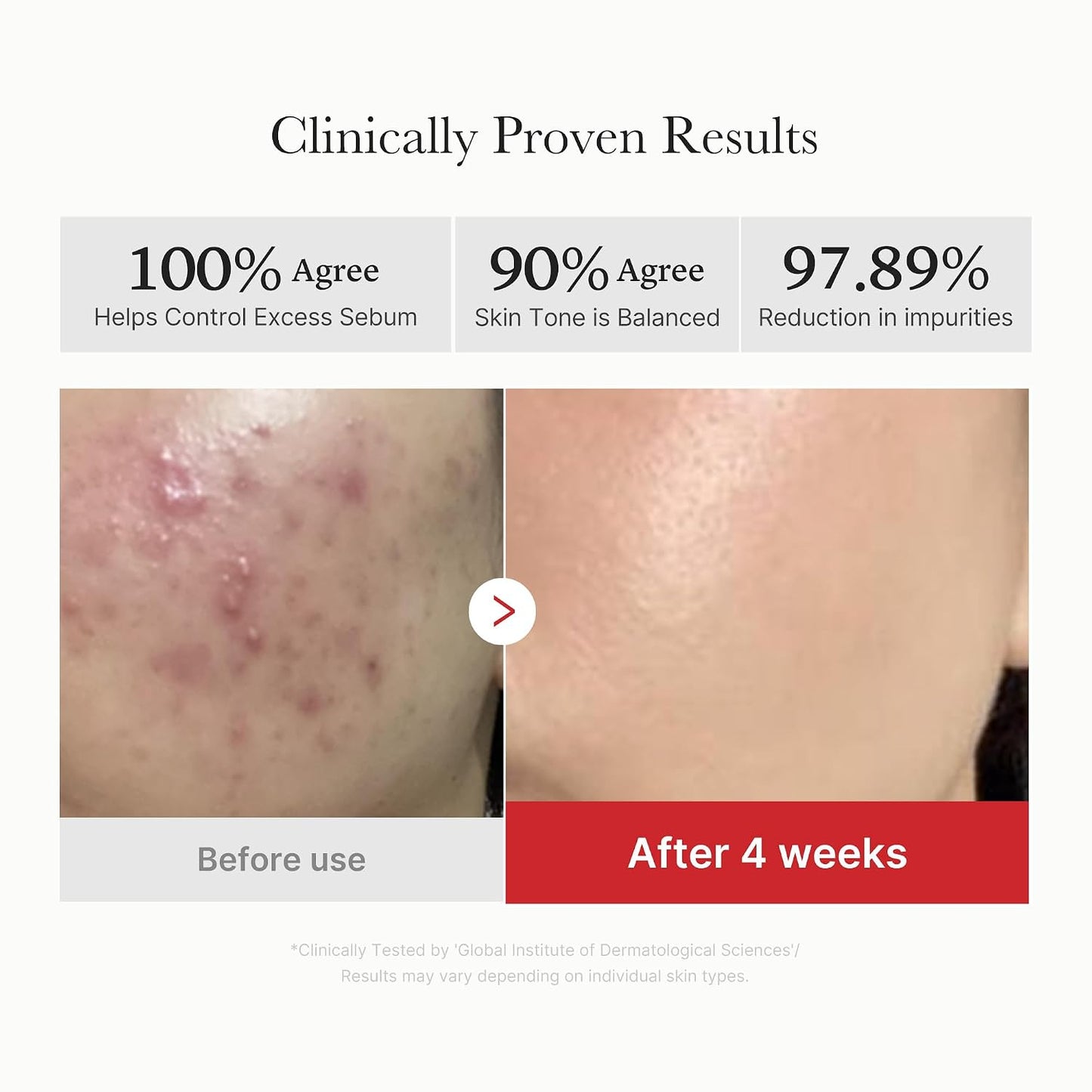 medicube Toner Pads Zero Pore Pad 2.0 for Exfoliation and Pore Care