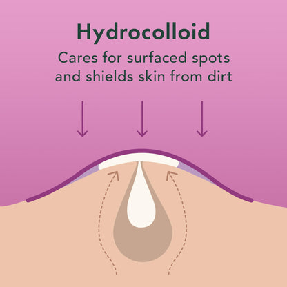 Rael Miracle Invisible Spot Cover Hydrocolloid Acne Pimple Patches (96 Ct)