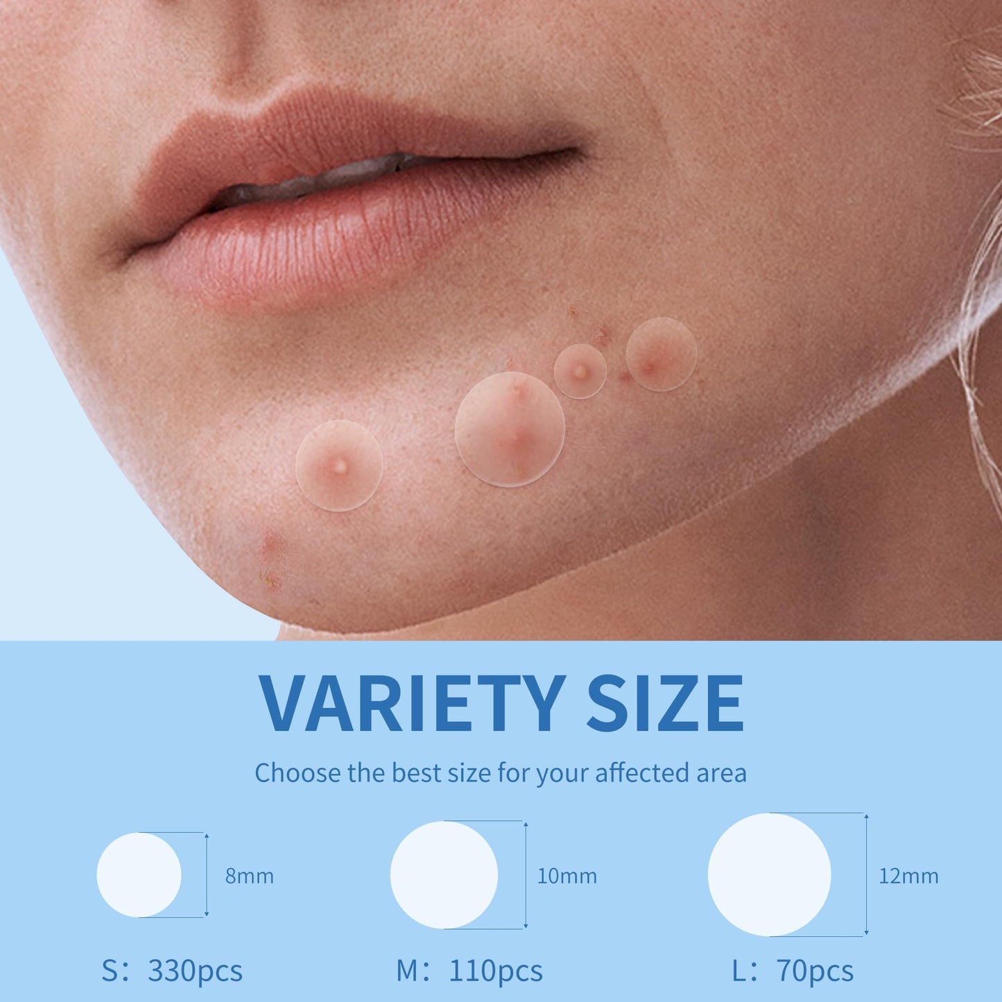 Daolyo 6 Sizes 142 Counts Large Acne Pimple Patches for Face