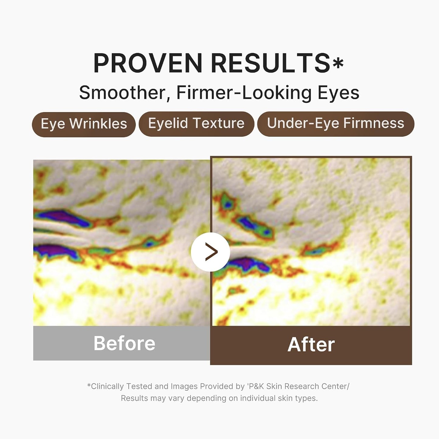 medicube Eye Serum with Salmon DNA PDRN & Pink Peptides