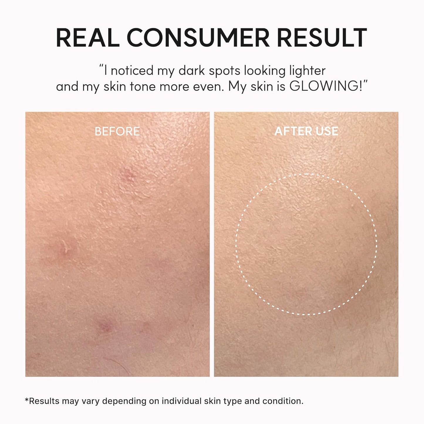 Arencia Vitamin C Booster Shot Serum with Glutathione, Niacinamide and Vitamin E for Dark Spot Care, Fine Lines & Wrinkles, Glass Skin, Korean Skincare 30ml/1.01 fl.oz