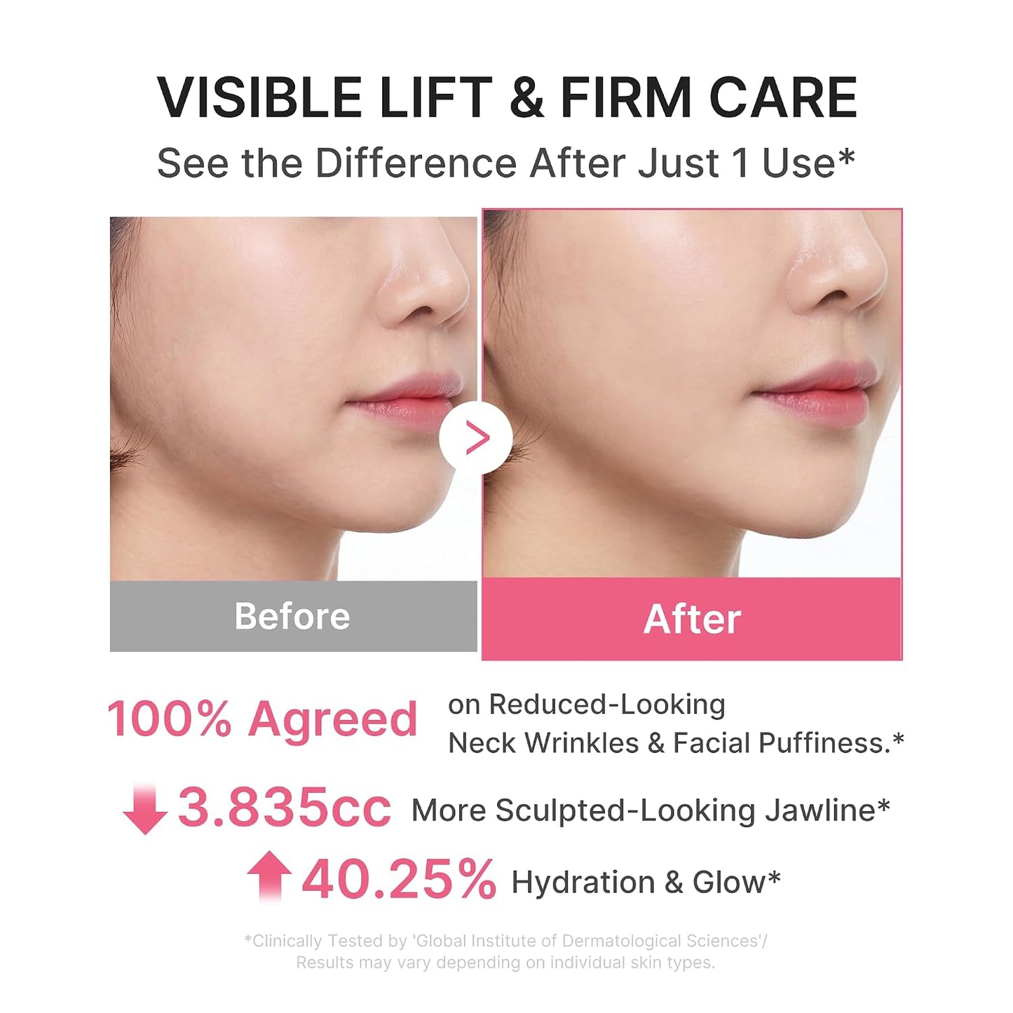 medicube PDRN Collagen Gua Sha Neck Wrinkle Cream - Firming, Contour Care