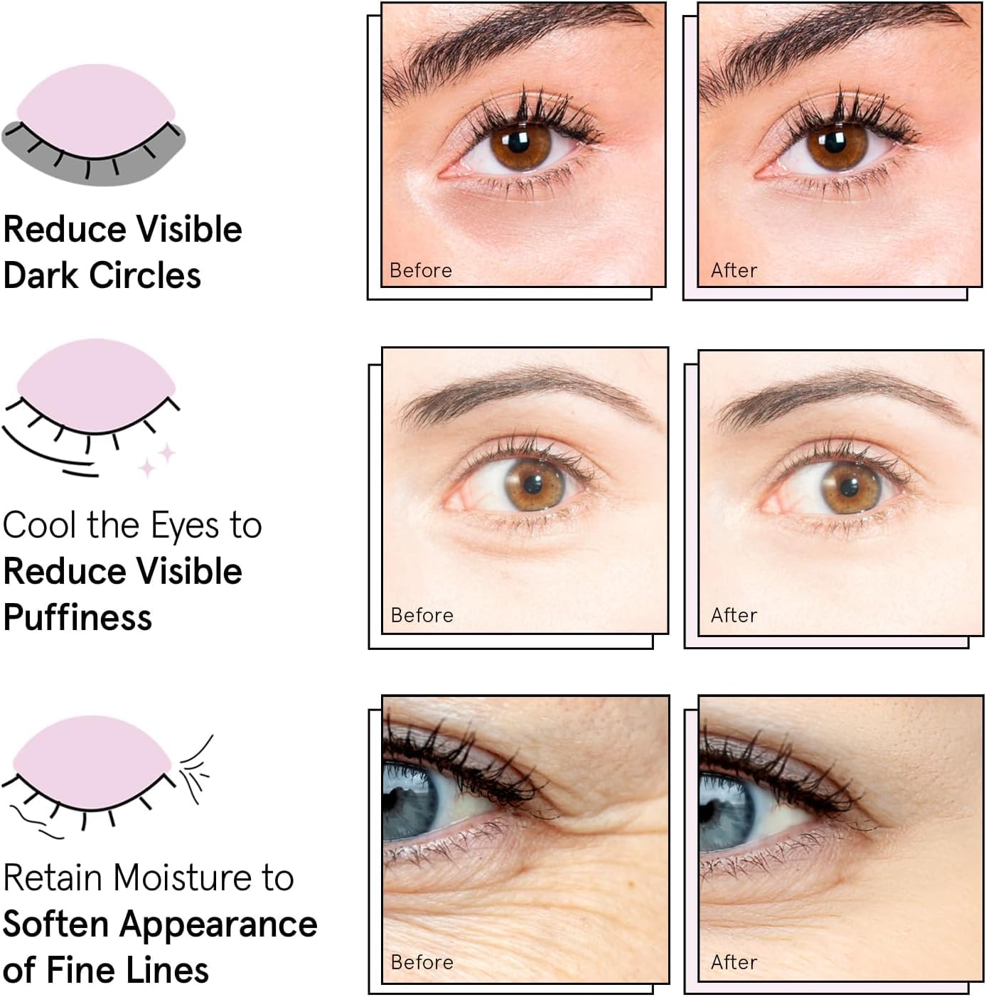 grace & stella Award Winning Eye Patches for Puffy Eyes