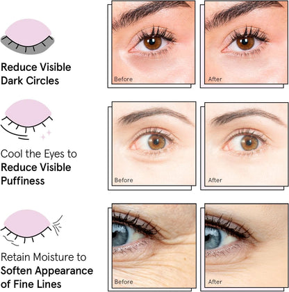 grace & stella Award Winning Eye Patches for Puffy Eyes