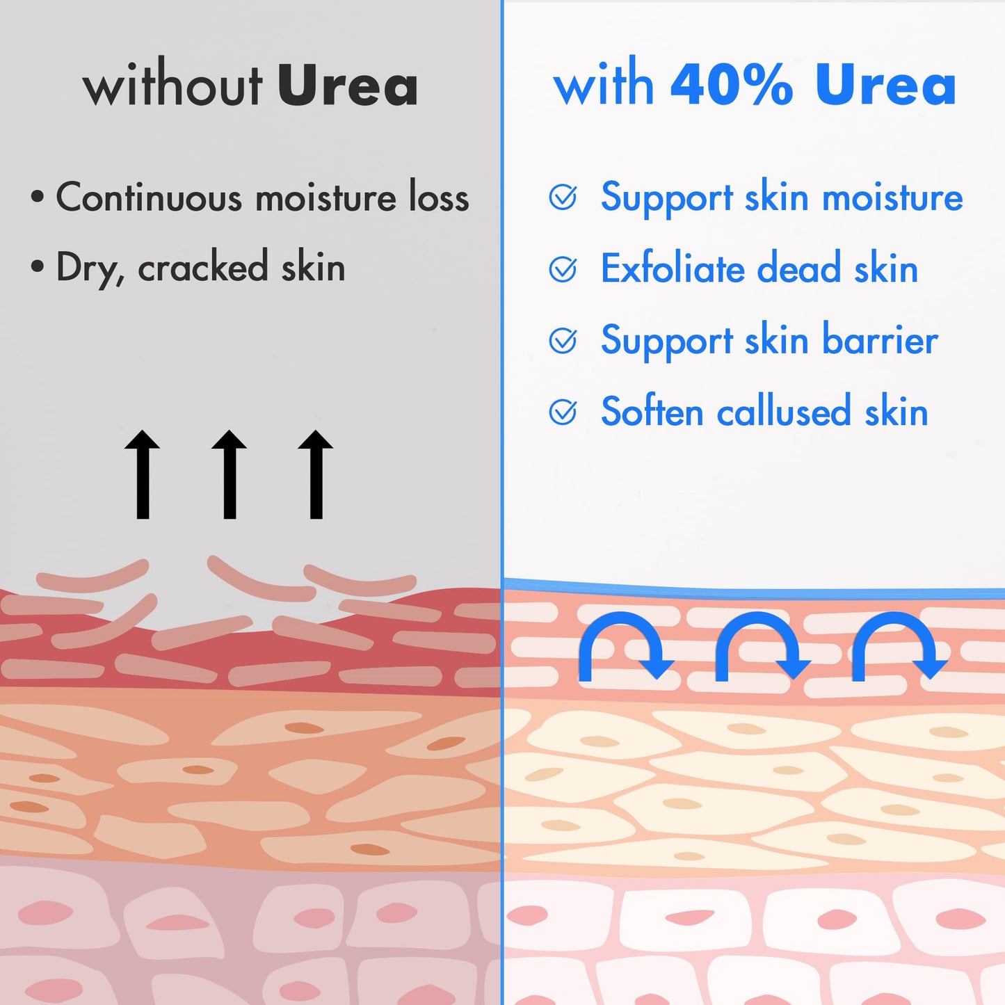 Ebanel Urea Cream 40% plus Salicylic Acid 2% for Dry Cracked Feet Skin, 2PK
