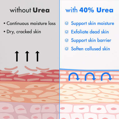 Ebanel Urea Cream 40% plus Salicylic Acid 2% for Dry Cracked Feet Skin, 2PK