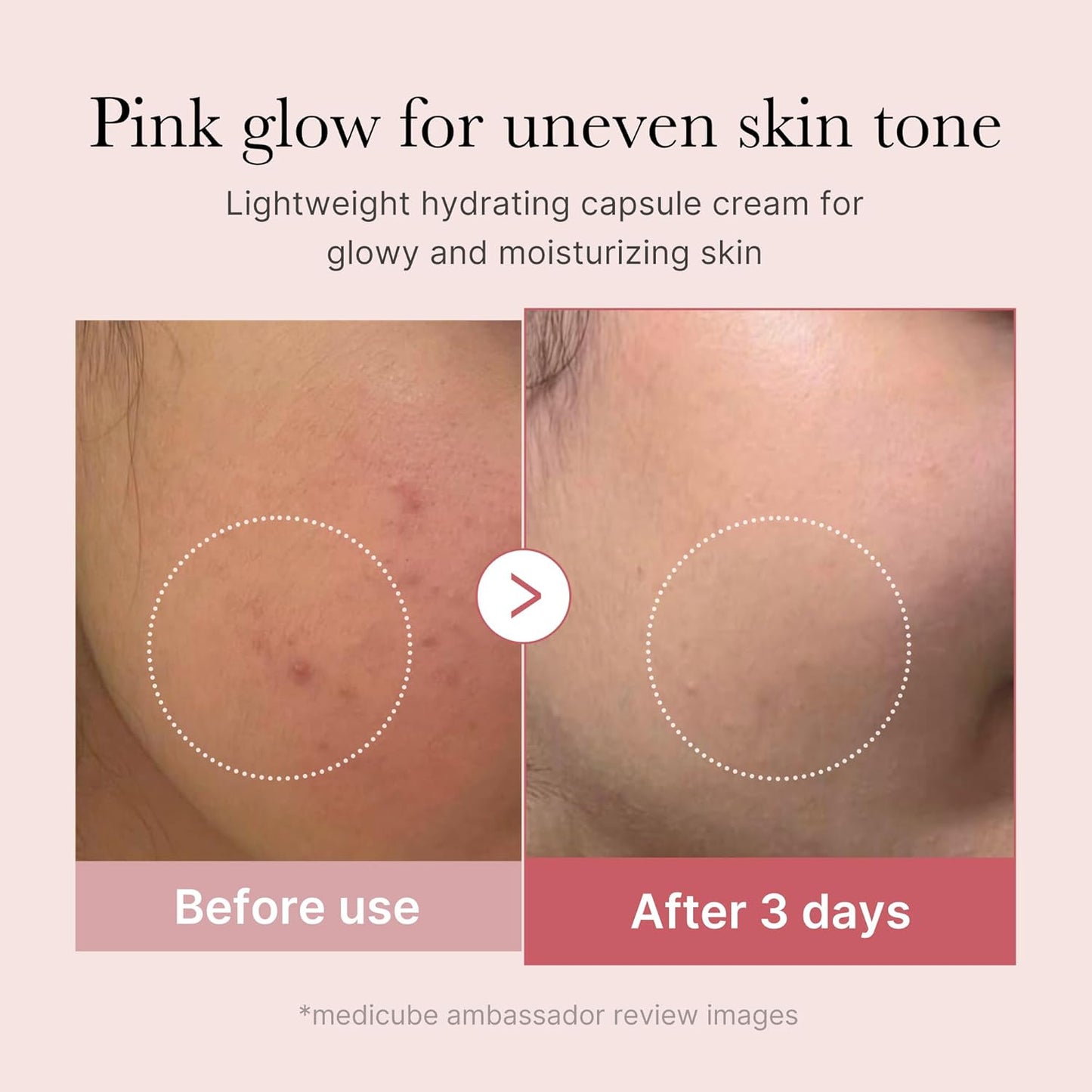 medicube Capsule Cream with Deep Vitamin C for Radiance