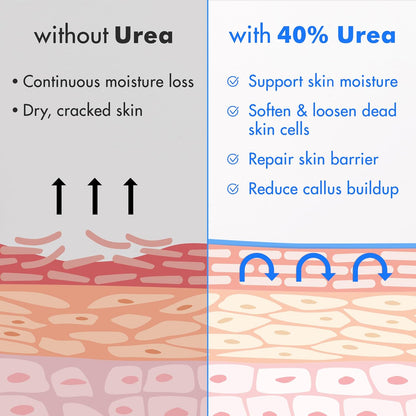Ebanel Urea Cream 40% plus Salicylic Acid 2% for Dry Cracked Feet Skin, 2PK