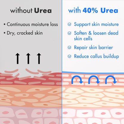 Ebanel Urea Cream 40% plus Salicylic Acid 2% for Dry Cracked Feet Skin, 2PK
