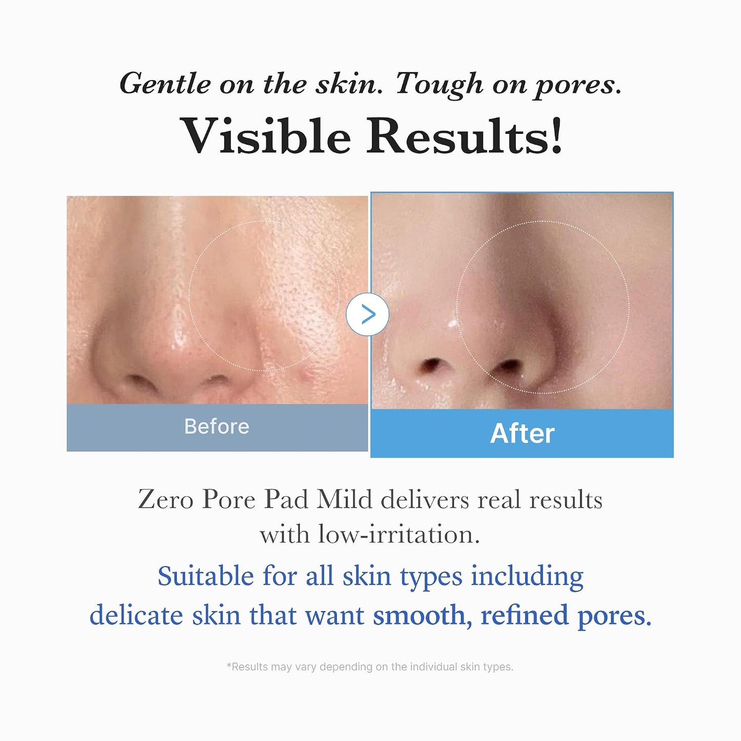 medicube Toner Pads Zero Pore Pad 2.0 for Exfoliation and Pore Care
