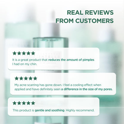 SKIN1004 [Hudson's Pick] Madagascar Centella Ampoule, Korean Face Serum with Centella Asiatica for Hydrating & Moisturizing, Soothing Facial Serum for Skin Balance, Korean Skin Care, 1.85 fl.oz, 55ml