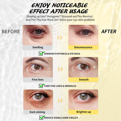 Maskiss 24k Gold Under Eye Patches (50 Pairs), eye mask, Collagen Skin Care Products, Eye Patches for Puffy Eyes, eye masks for dark circles and puffiness
