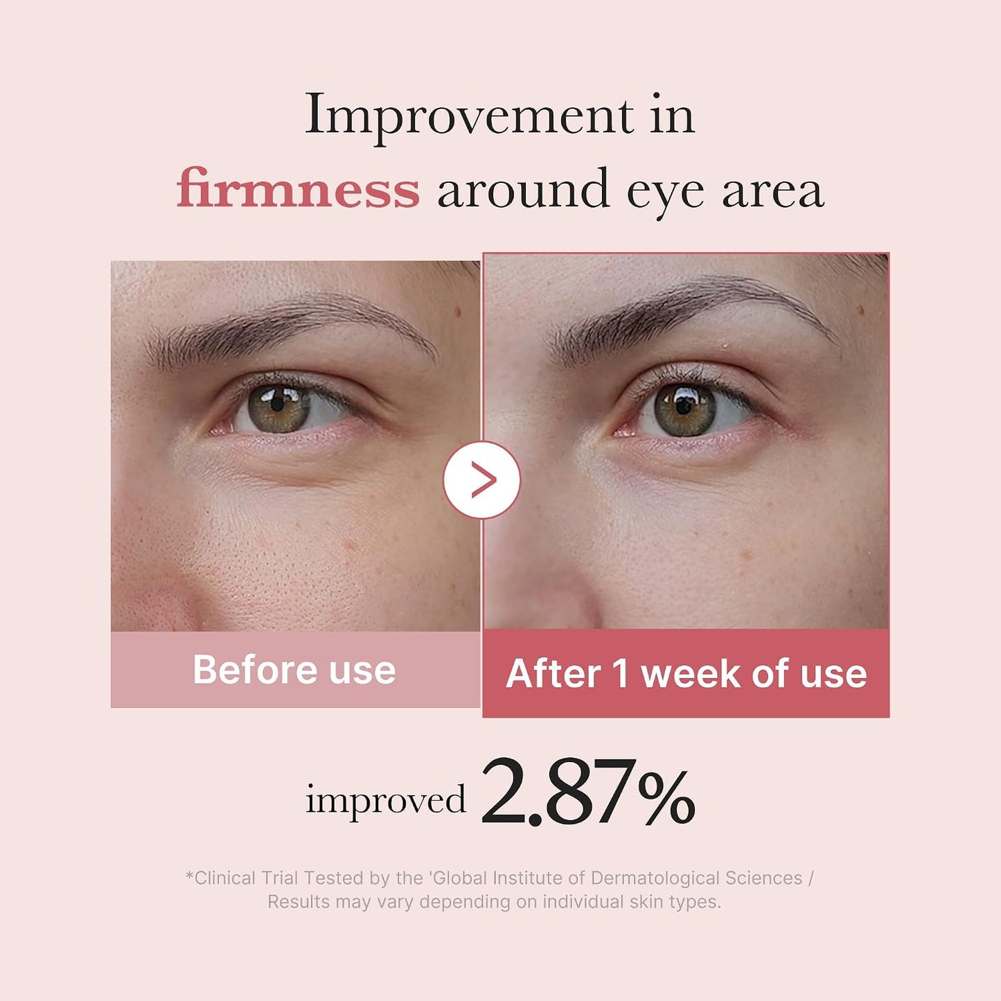 medicube Eye Serum with Salmon DNA PDRN & Pink Peptides