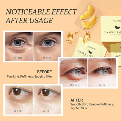 PEAUAMIE Under Eye Patches Gold and Hyaluronic Acid for puffy eyes,Rose Eye Masks for Dark Circles and Puffiness skin care Smooth Wrinkles products 30 Pairs