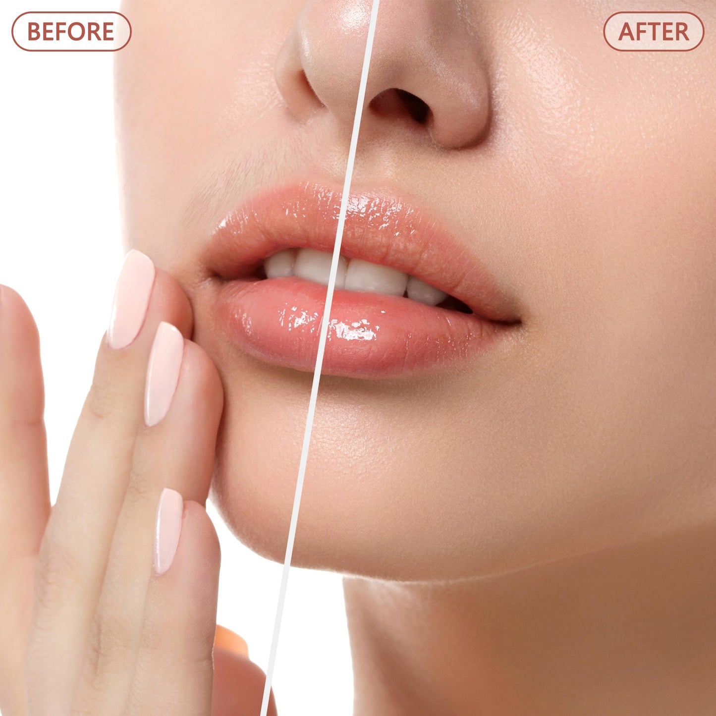 Facial Hair Remover for Women - as Seen on TV Painless Face Shaver - Electric Hair Removal Device for Face Lips Peach Fuzz with Light (White)