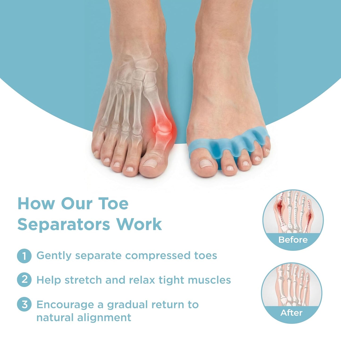 Mind Bodhi Toe Separators/Toe Spacers - Men & Women - Regular Size - Blue
