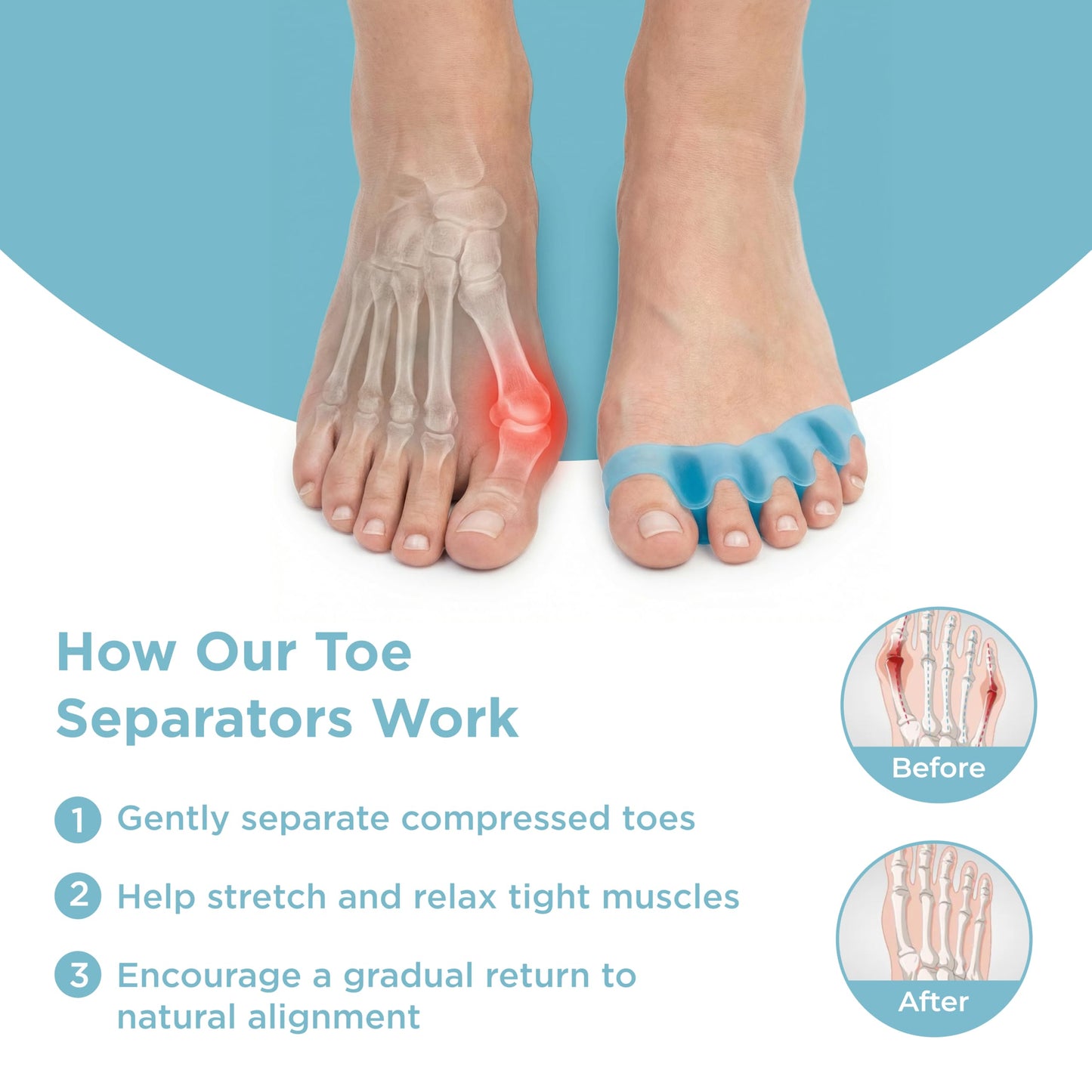 Mind Bodhi Toe Separators/Toe Spacers - Men & Women - Regular Size - Blue