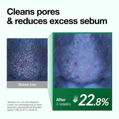 Anua Heartleaf Pore Control Cleansing Oil, Korean Skincare, 6.76 fl.oz