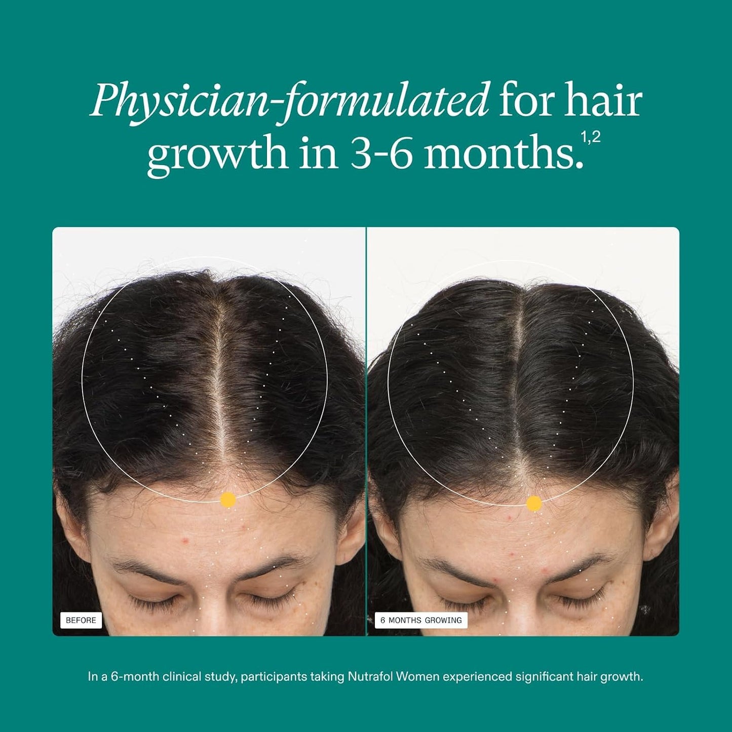 Nutrafol Women Hair Growth Supplements, Ages 18-44, 1-Month Bottle