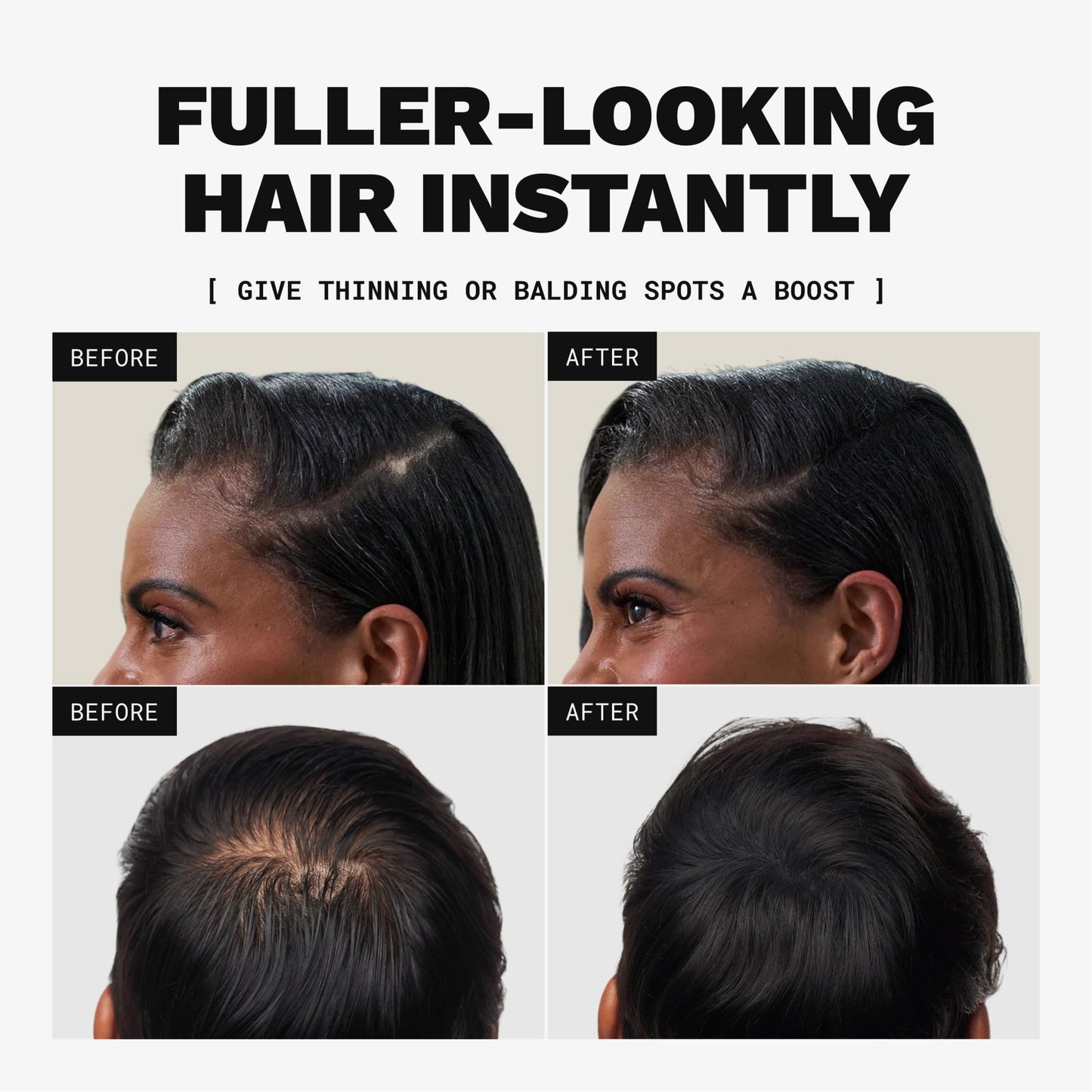 Toppik Hair Building Fibers, Fill In Fine or Thinning Hair Instantly Thicker, Fuller Looking Hair 9 Shades,4 size options