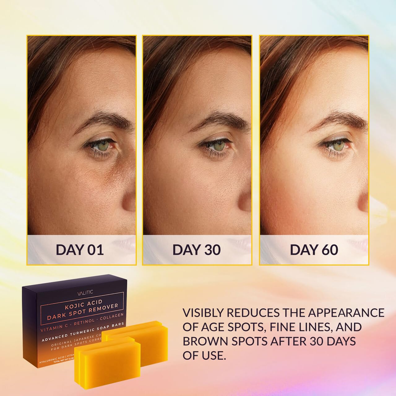 VALITIC Kojic Acid Dark Spot Remover Soap Bars, Turmeric Bar Soaps 2 Pack