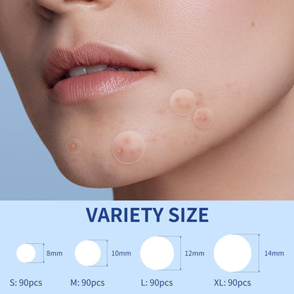 Daolyo 6 Sizes 142 Counts Large Acne Pimple Patches for Face