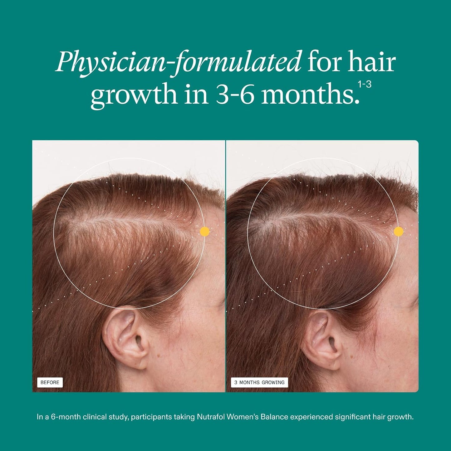 Nutrafol Women's Balance Hair Growth Supplements, Age 45+, 1-Month Bottle