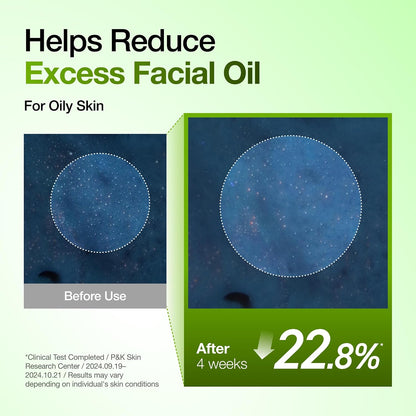 Anua Azelaic Acid 10 Hyaluron Redness Soothing Serum, 1.01 fl oz | Facial Serum for Blemish-Prone & Oily-Prone Skin, Lightweight & Hydrating Blemish Care, Hyaluronic Acid, Korean Skincare