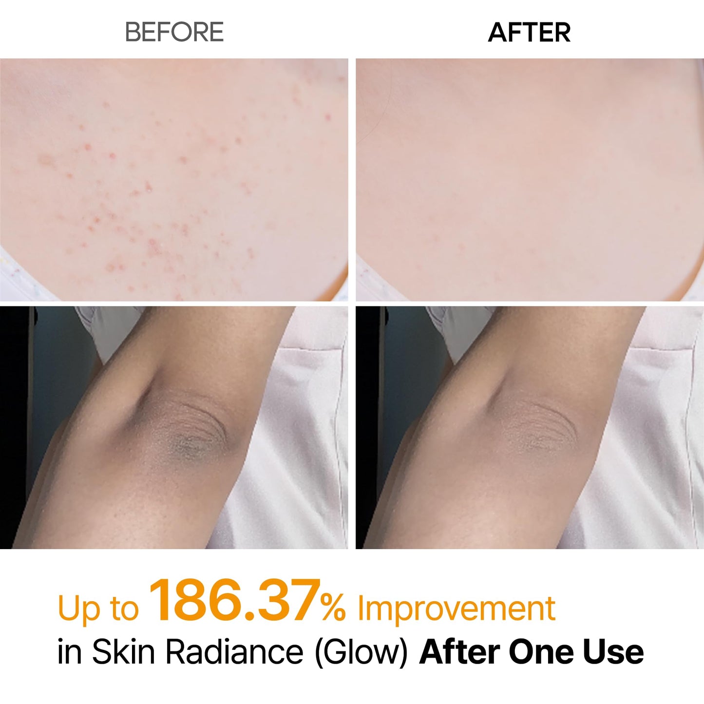 Dr.Melaxin Peel Shot Exfoliating TX-Spray 6.76 fl.oz - 99% Tranexamic Acid and Niacinamide Body Exfoliator Spray for Uneven Skin Tone, AHA PHA Body Peel for Rough Skin, K-Beauty Body Brightening