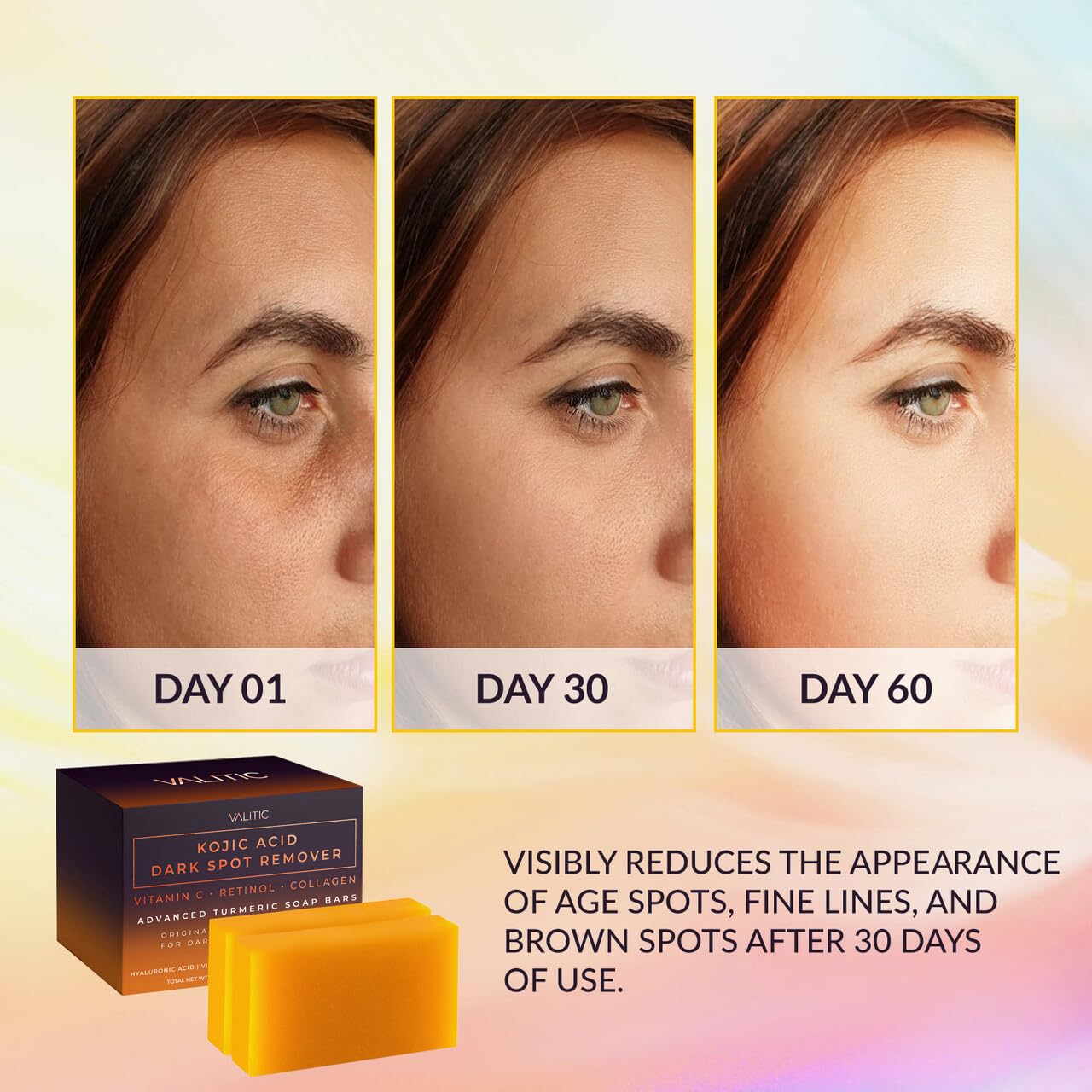 VALITIC Kojic Acid Dark Spot Remover Soap Bars, Turmeric Bar Soaps 2 Pack
