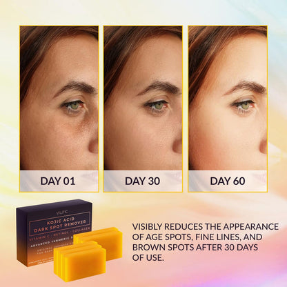VALITIC Kojic Acid Dark Spot Remover Soap Bars, Turmeric Bar Soaps 2 Pack