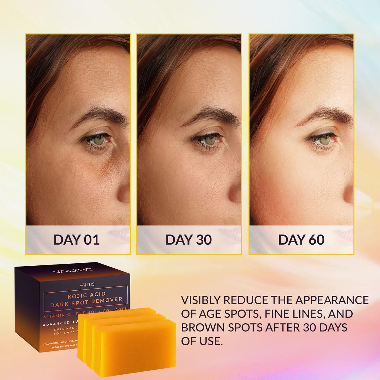 VALITIC Kojic Acid Dark Spot Remover Soap Bars, Turmeric Bar Soaps 2 Pack