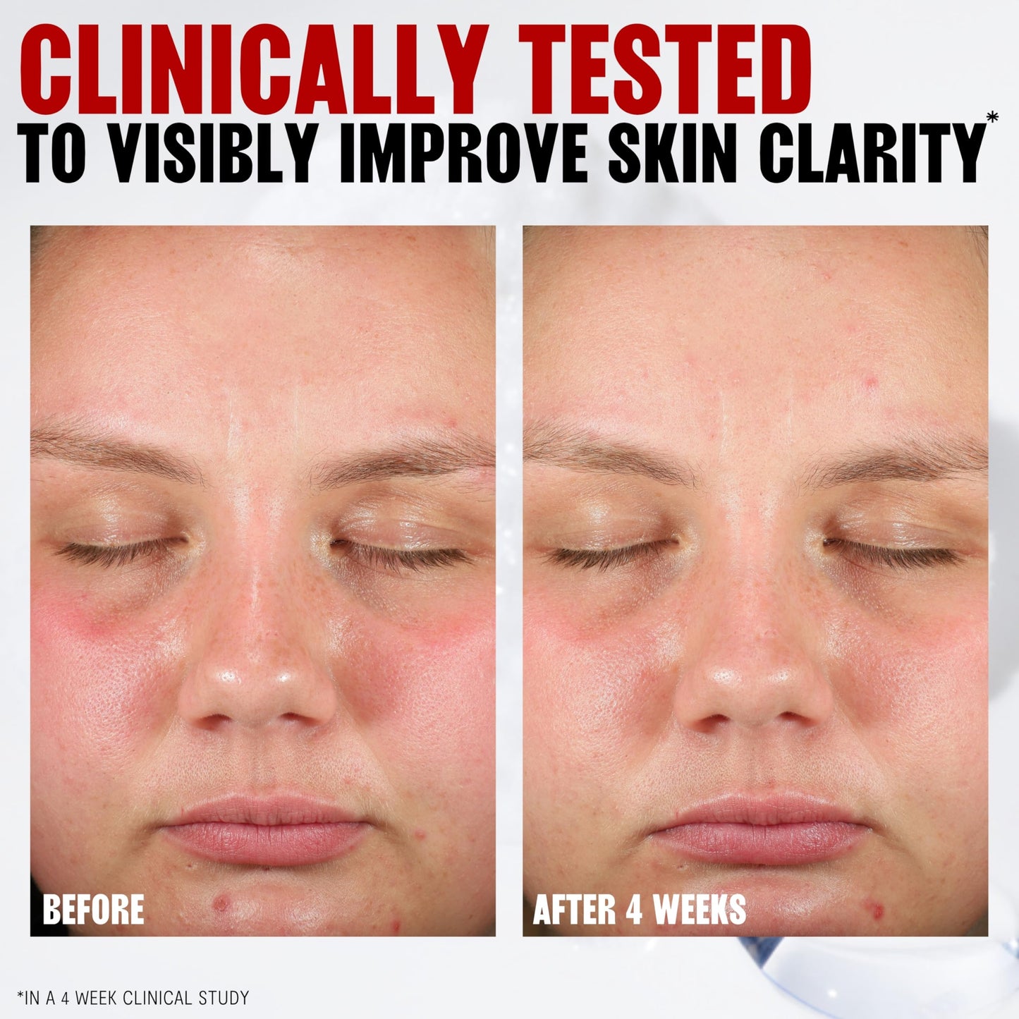 Thayers Blemish Clearing Acne Pads, Salicylic Acid Acne Treatment for Face, Pore Reducing, Exfoliating, and Soothing Skincare, Witch Hazel Toner Pads, 60 Ct