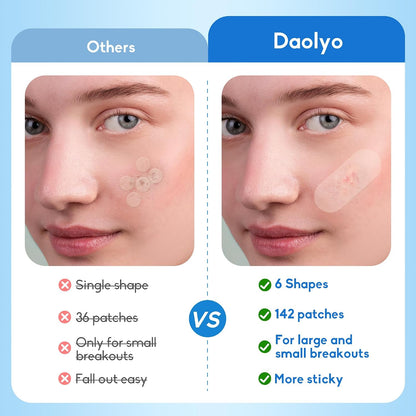 Daolyo 6 Sizes 142 Counts Large Acne Pimple Patches for Face