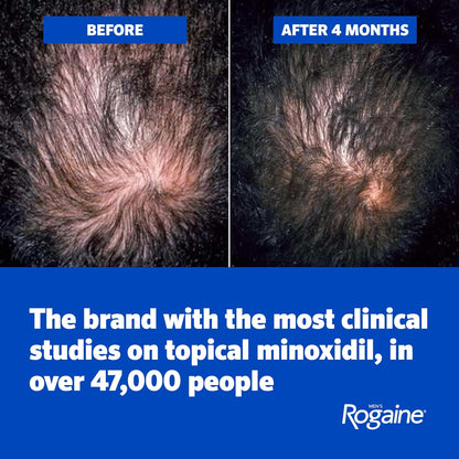 Men's Rogaine 5% Minoxidil Topical Foam, Unscented, 3 Mo Supply, 3x 2.11 Oz