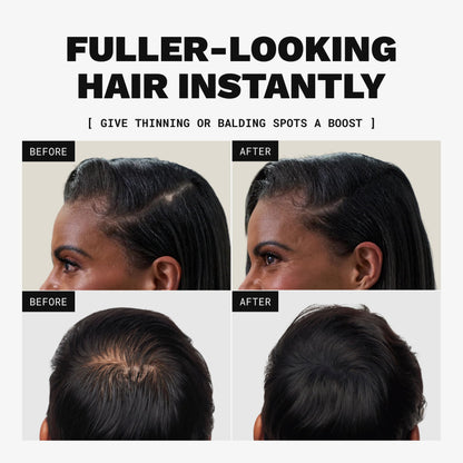 Toppik Hair Building Fibers, Fill In Fine or Thinning Hair Instantly Thicker, Fuller Looking Hair 9 Shades,4 size options