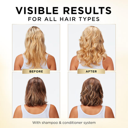 Pantene Shampoo & Conditioner Set, Daily Moisture Renewal - Pro-V Nutrients for Dry, Color-Treated, Straight to Curly Hair, 72-Hour Hydration & Softness, 52.8 Oz Total + Miracle Rescue Shot (0.5 Oz)