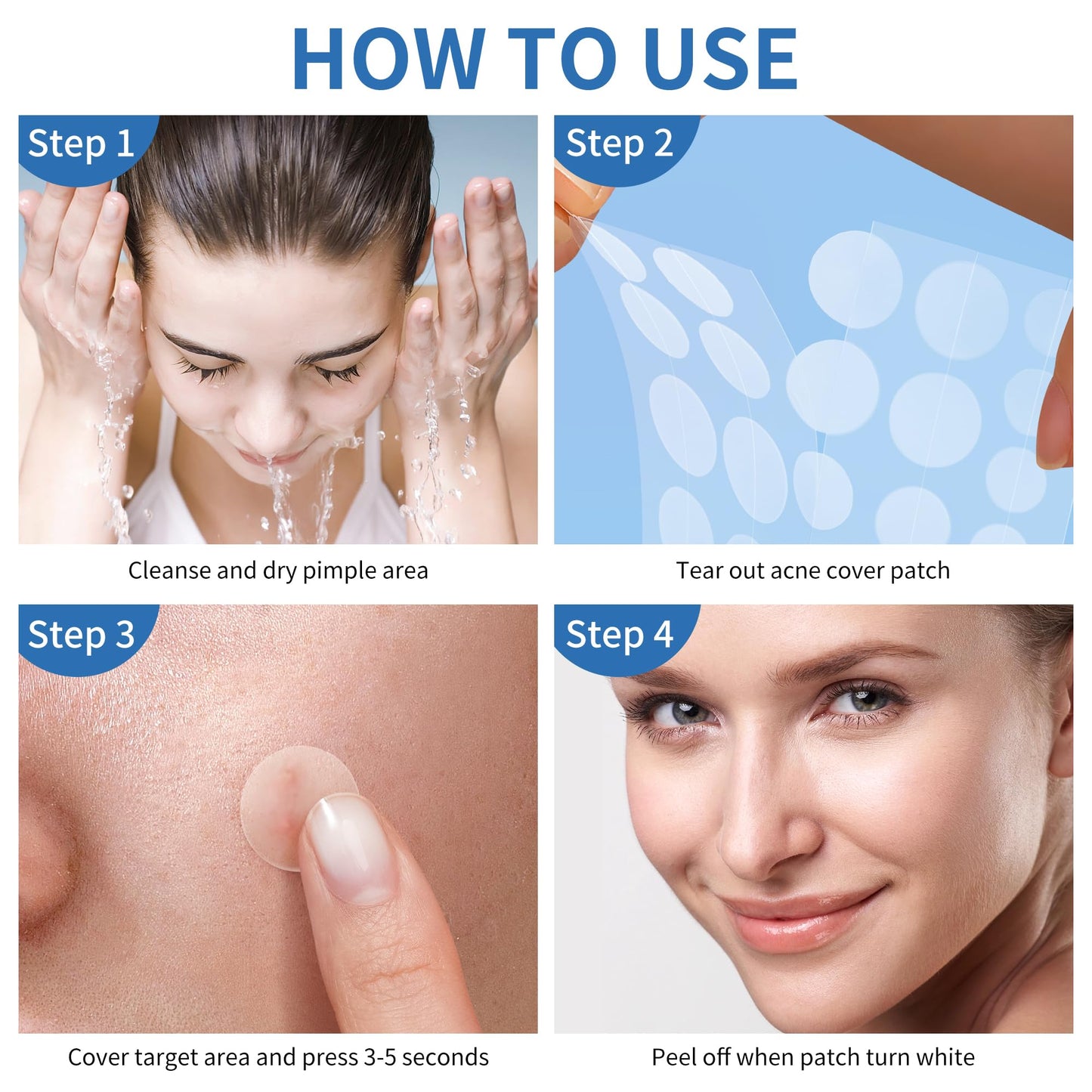 Daolyo 6 Sizes 142 Counts Large Acne Pimple Patches for Face