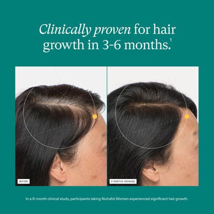 Nutrafol Women Hair Growth Supplements, Ages 18-44, 1-Month Bottle