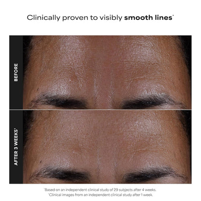 Paula's Choice SKIN PERFECTING 2% BHA Liquid Exfoliant