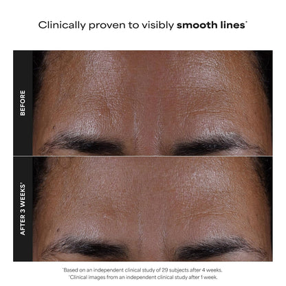 Paula's Choice SKIN PERFECTING 2% BHA Liquid Exfoliant