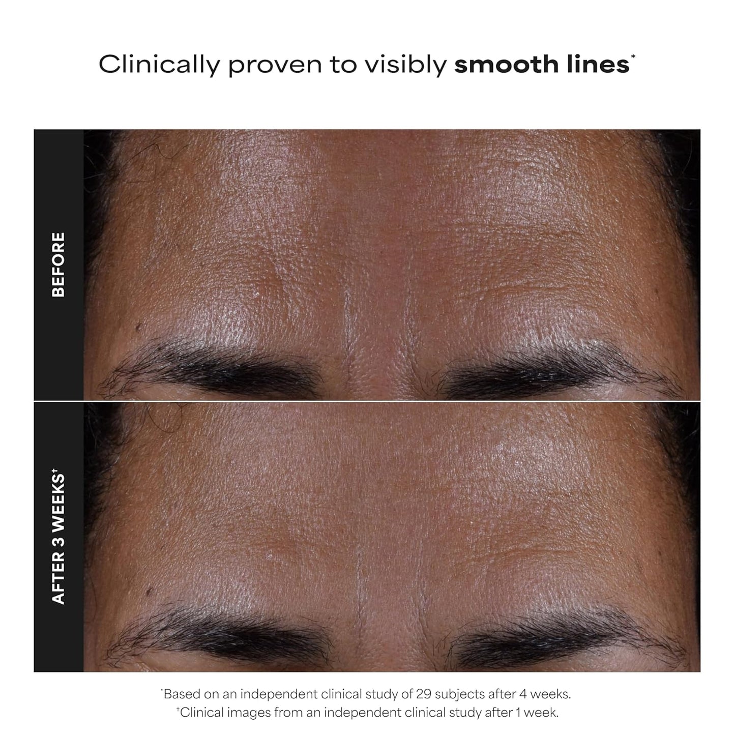 Paula's Choice SKIN PERFECTING 2% BHA Liquid Exfoliant