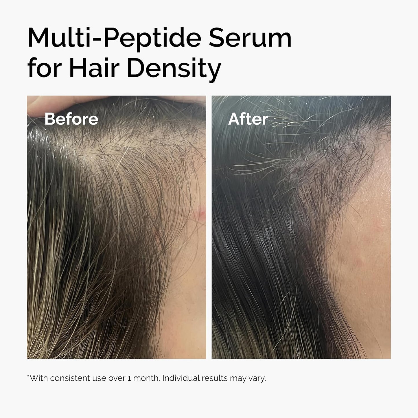 The Ordinary Multi-Peptide Serum for Hair Density, Peptide-Powered Formula for Thicker, Fuller Looking Hair