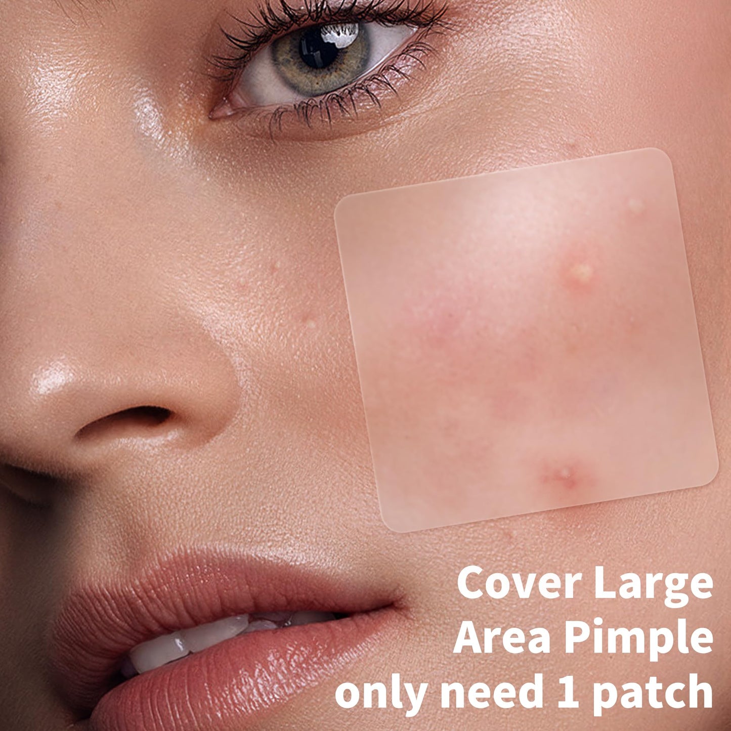 Daolyo 6 Sizes 142 Counts Large Acne Pimple Patches for Face