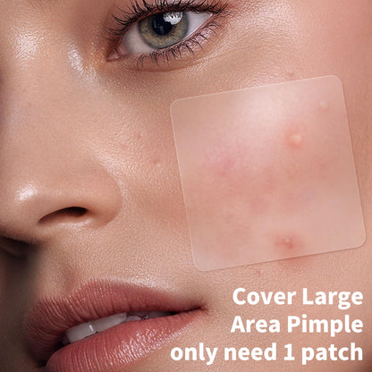 Daolyo 6 Sizes 142 Counts Large Acne Pimple Patches for Face