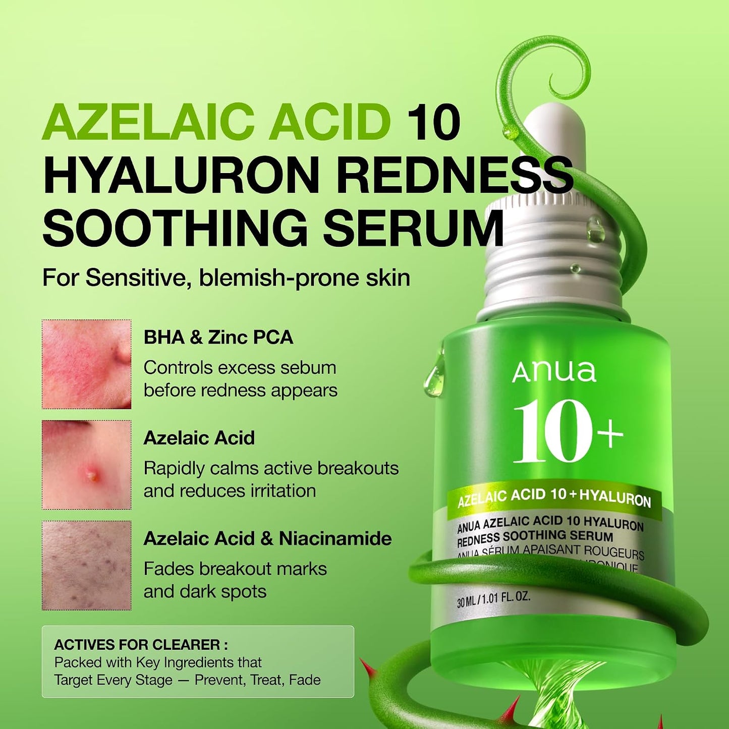 Anua Azelaic Acid 10 Hyaluron Redness Soothing Serum, 1.01 fl oz | Facial Serum for Blemish-Prone & Oily-Prone Skin, Lightweight & Hydrating Blemish Care, Hyaluronic Acid, Korean Skincare