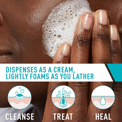 CeraVe Foaming Acne Cream Cleanser, Face Wash with 4% Benzoyl Peroxide, 5oz