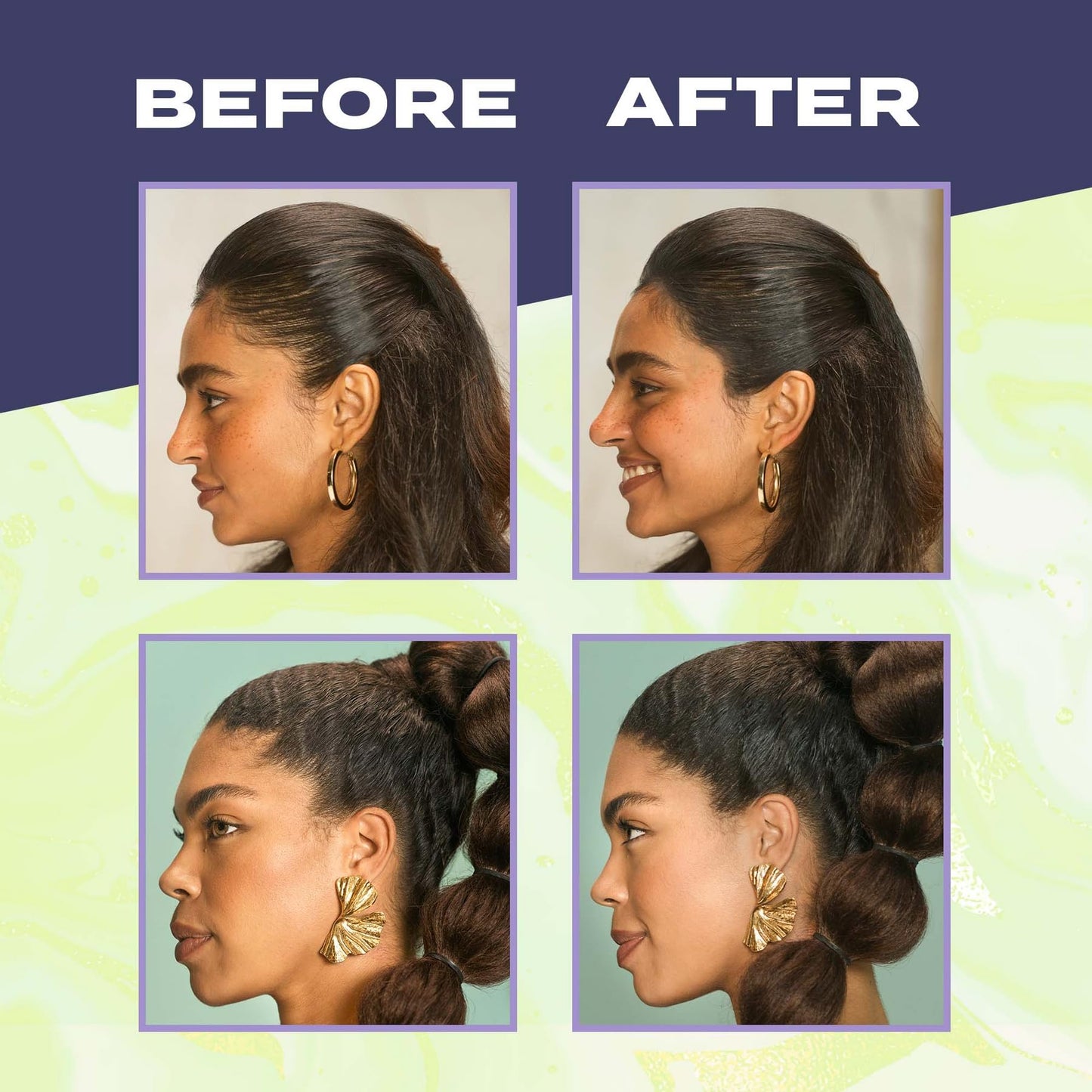Toppik Hair Building Fibers, Fill In Fine or Thinning Hair Instantly Thicker, Fuller Looking Hair 9 Shades,4 size options