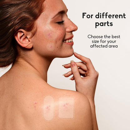 Daolyo 6 Sizes 142 Counts Large Acne Pimple Patches for Face