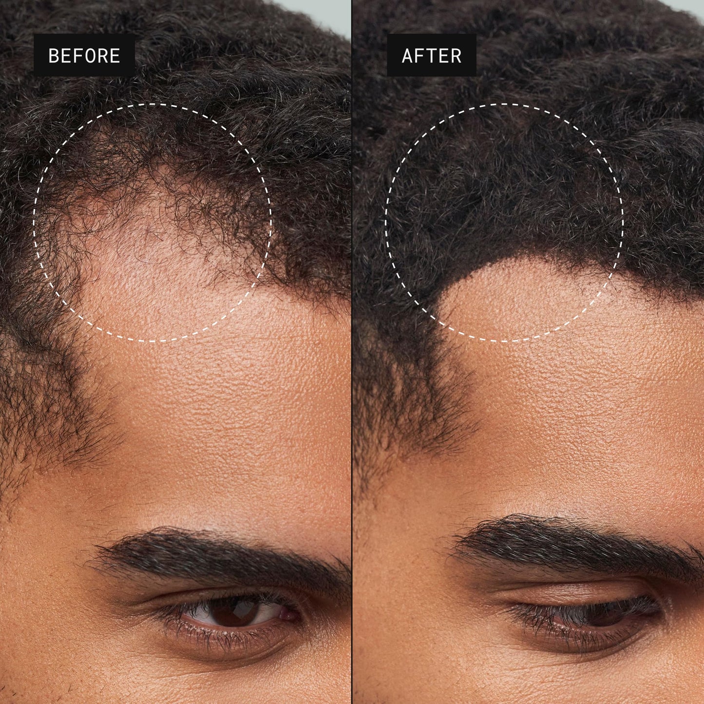 Toppik Hair Building Fibers, Fill In Fine or Thinning Hair Instantly Thicker, Fuller Looking Hair 9 Shades,4 size options